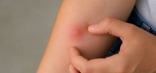 Bouton qui gratte comme une piqûre de moustique : causes et solutions